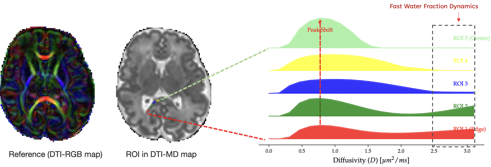 DBM mapping neonatal Corpus Callosum development