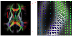 DTI: Diffusion tensor map